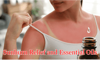 a women with a bad sunburn relief