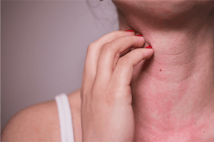 Itching skin on neck due to allergy