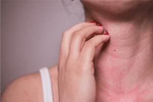 a guide to safe and effective cleaning 12 Itching skin on neck due to allergy