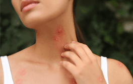a women with an itchy rash on her neck.do i have chemical sensitization or a chemical allergy