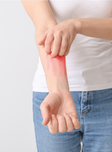 itching a skin rash, do i have chemical sensitization or a chemical allergy