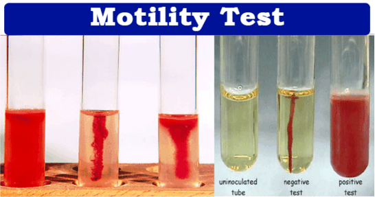 Stab test for mobility of bacteria, how microbiogists identify bacteria in a lab