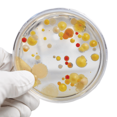 pietry dish of bacteria